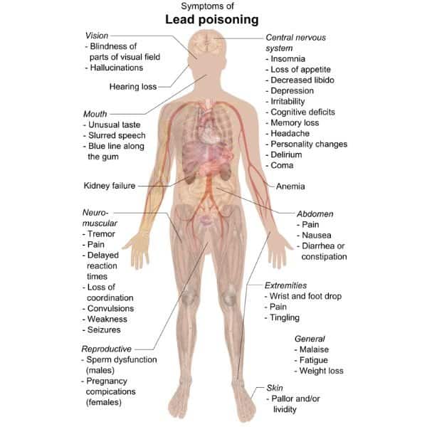 Symptoms of lead poisoning 